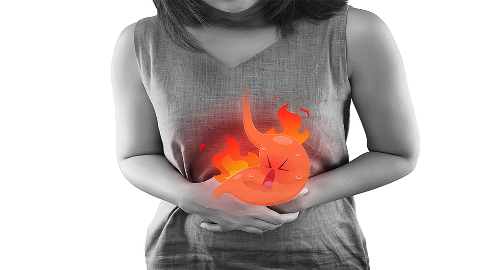 What Causes Heartburn Everyday – Hiatal Hernia